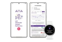 Samsung Smartwatch: Heart Health Tracking Now Detects Cardiovascular Conditions.