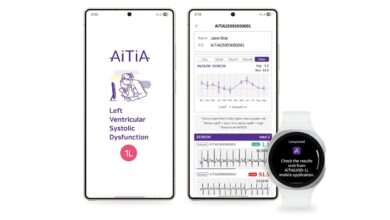 Samsung Smartwatch: Heart Health Tracking Now Detects Cardiovascular Conditions.