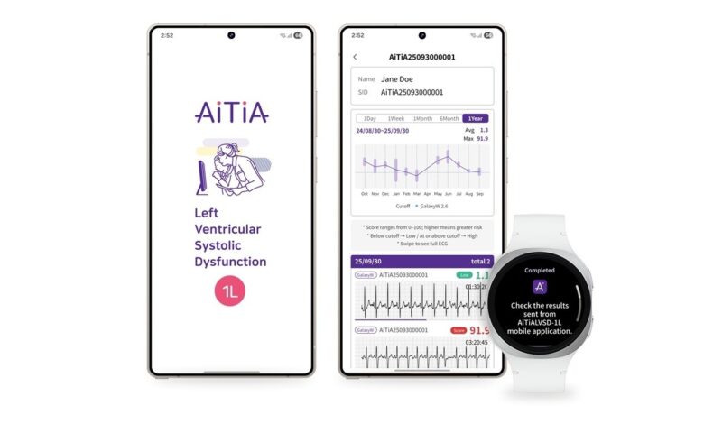Samsung Smartwatch: Heart Health Tracking Now Detects Cardiovascular Conditions.